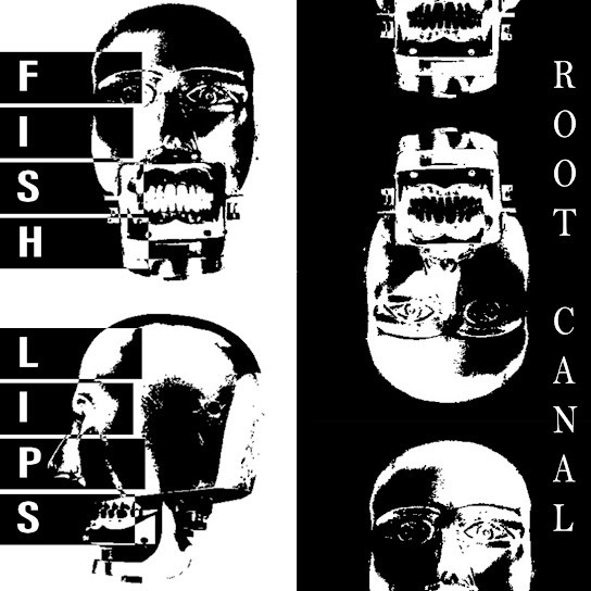 Root Canal cover art